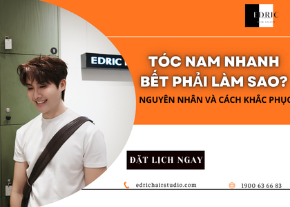 Tóc nam nhanh bết phải làm sao? Nguyên nhân và cách khắc phục hiệu quả
