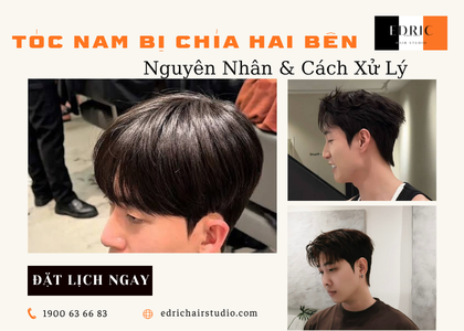 Tóc Nam Bị Chỉa Hai Bên – Vì Sao Và Cách Xử Lý Hiệu Quả