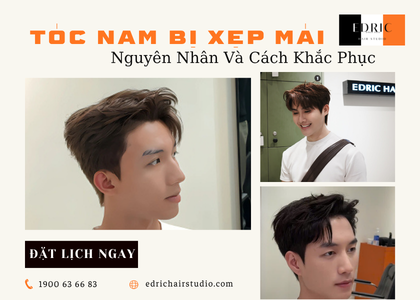 Tóc Nam Bị Xẹp Phần Mái – Nguyên Nhân & Cách Khắc Phục